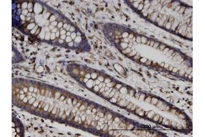 Immunoperoxidase of monoclonal antibody to TUBB on formalin-fixed paraffin-embedded human colon. (TUBB antibody  (AA 1-444))