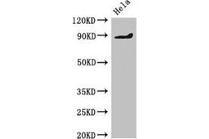 Western Blot Positive WB detected in: Hela whole cell lysate All lanes: PDE2A antibody at 2 μg/mL Secondary Goat polyclonal to rabbit IgG at 1/50000 dilution Predicted band size: 106, 104, 105, 79, 88 kDa Observed band size: 88 kDa