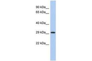 Image no. 1 for anti-14-3-3 epsilon (YWHAE) (C-Term) antibody (ABIN6744347) (YWHAE antibody  (C-Term))