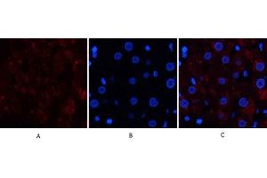 Immunofluorescence analysis of human liver tissue. (Catalase antibody  (C-Term))