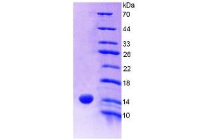 SDS-PAGE (SDS) image for S100 Calcium Binding Protein A9 (S100A9) ELISA Kit (ABIN6730867)