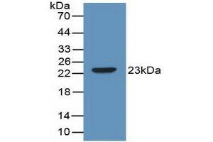 Detection of Recombinant IL2, Mouse using Polyclonal Antibody to Interleukin 2 (IL2) (IL-2 antibody  (AA 10-169))