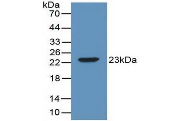 IL-2 anticorps  (AA 10-169)