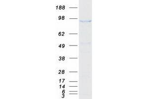 Validation with Western Blot (SMEK1 Protein (Myc-DYKDDDDK Tag))