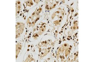 Immunohistochemistry of paraffin-embedded human stomach using NFATC1 antibody at dilution of 1:200 (x400 lens).
