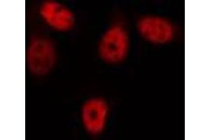 ABIN6274351 staining HepG2 cells by IF/ICC. (GIT2 antibody  (Internal Region))