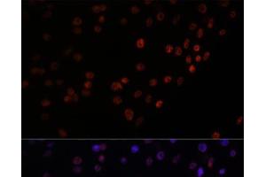 Immunofluorescence (IF) image for anti-Matrin 3 (MATR3) antibody (ABIN7261858)