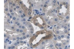 Detection of PCYOX1 in Mouse Kidney Tissue using Polyclonal Antibody to Prenylcysteine Oxidase 1 (PCYOX1) (PCYOX1 antibody  (AA 249-505))