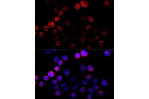 Immunofluorescence analysis of HeLa cells using Aromatase (CYP19) antibody (2684) at dilution of 1:100 (40x lens). (Aromatase antibody  (AA 1-180))