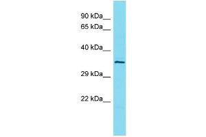 Host: Rabbit Target Name: L3HYPDH Sample Type: OVCAR-3 Whole Cell lysates Antibody Dilution: 1. (L3HYPDH antibody  (C-Term))
