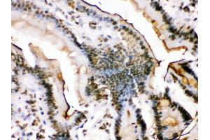 Immunohistochemistry (Paraffin-embedded Sections) (IHC (p)) image for anti-FBJ Murine Osteosarcoma Viral Oncogene Homolog B (FOSB) (AA 264-291), (C-Term) antibody (ABIN3042399)