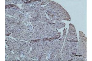 Immunohistochemical analysis of paraffin-embedded Mouse PancreasTissue using TRIM72 Polyclonal Antibody. (TRIM72 antibody)