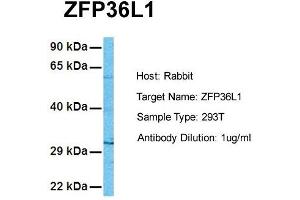 Host: Rabbit Target Name: ZFP36L1 Sample Tissue: Human 293T Antibody Dilution: 1. (ZFP36L1 antibody  (N-Term))