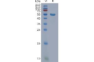 Human D Protein, hFc Tag on SDS-PAGE under reducing condition.