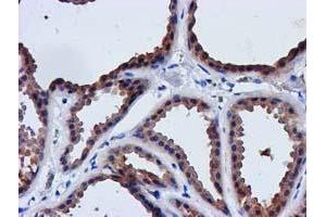 Immunohistochemical staining of paraffin-embedded Human breast tissue using anti-LACTB2 mouse monoclonal antibody. (LACTB2 antibody  (AA 78-288))