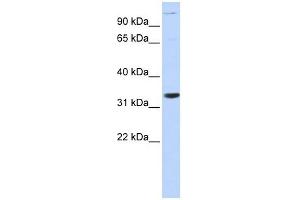 ANP32B antibody used at 1 ug/ml to detect target protein. (ANP32B antibody)