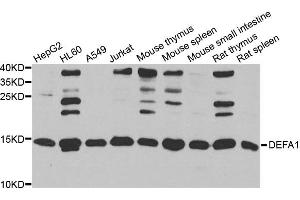 Western blot analysis of extracts of various cell lines, using DEFA1 antibody (ABIN5974152) at 1/1000 dilution. (alpha Defensin 1 antibody)