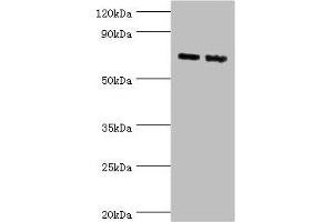 Western blot All lanes: Amyloid-like protein 1 antibody at 6 μg/mL Lane 1: Mouse brain tissue Lane 2: A549 whole cell lysate Secondary Goat polyclonal to rabbit IgG at 1/10000 dilution Predicted band size: 72 kDa Observed band size: 72 kDa (APLP1 antibody  (AA 39-300))
