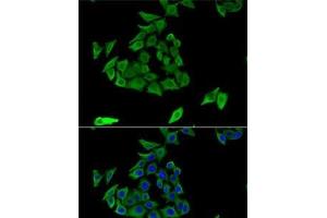 Immunofluorescence analysis of U2OS cells using TGM3 Polyclonal Antibody