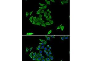 Immunofluorescence analysis of U2OS cells using TGM3 Polyclonal Antibody (TGM3 antibody)