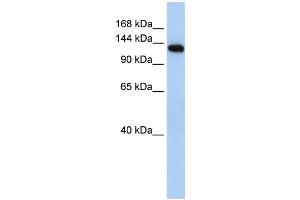 WB Suggested Anti-MYBPC2 Antibody Titration:  0. (MYBPC2 antibody  (N-Term))