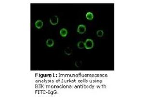Image no. 3 for anti-Bruton Agammaglobulinemia tyrosine Kinase (BTK) antibody (ABIN232137) (BTK antibody)