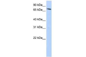 SLC11A2 antibody used at 1 ug/ml to detect target protein. (SLC11A2 antibody  (N-Term))