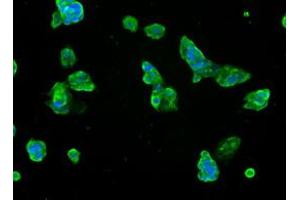 Immunofluorescent staining of HepG2 cells using anti-SLC7A8 mouse monoclonal antibody (ABIN2453649). (SLC7A8 antibody)
