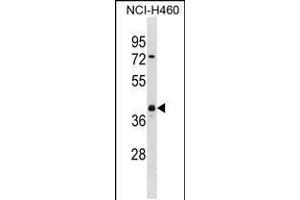 Western blot analysis in NCI-H460 cell line lysates (35ug/lane). (UCHL5 antibody  (AA 136-164))
