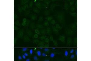 Immunofluorescence analysis of U2OS cells using ATP1A1 Polyclonal Antibody at dilution of 1:100. (ATP1A1 antibody)