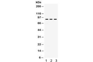 Western blot testing of 1) rat brain, 2) mouse spleen and 3) human U87 lysate with AFG3L2 antibody. (AFG3L2 antibody)