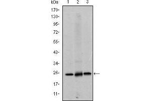Western blot analysis using EIF4E mouse mAb against Hela (1), HEK293 (2) and K562 (3) cell lysate. (EIF4E antibody)