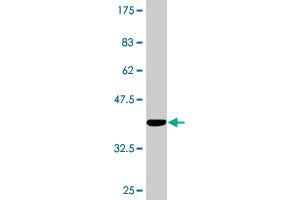 Western Blot detection against Immunogen (37. (SIRT3 antibody  (AA 297-399))