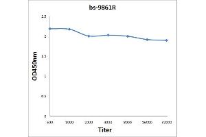 Antigen: 2 µg/100 µL  Primary: Antiserum, 1:500, 1:1000, 1:2000, 1:4000, 1:8000, 1:16000, 1:32000;  Secondary: HRP conjugated Rabbit Anti-Goat IgG at 1: 5000;  TMB staining Read the data in Microplate Reader by 450nm. (Titin antibody  (AA 2670-2703))