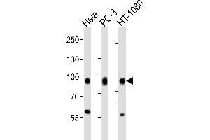 Western blot analysis of lysates from Hela, PC-3, HT-1080 cell line (from left to right), using CD44 Antibody (C-term) . (CD44 antibody  (C-Term))