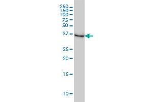 NMI monoclonal antibody (M01), clone 9D8 Western Blot analysis of NMI expression in HeLa . (NMI antibody  (AA 1-100))