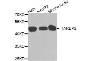 Western blot analysis of extracts of various cell lines, using TARBP2 antibody.