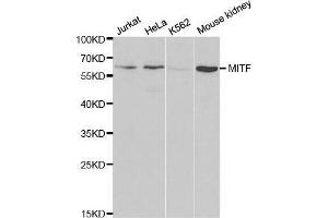 Western blot analysis of extracts of various cell lines, using MITF antibody. (MITF antibody  (AA 1-280))
