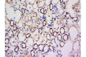 Paraformaldehyde-fixed, paraffin embedded human kidney, Antigen retrieval by boiling in sodium citrate buffer (pH6) for 15min, Block endogenous peroxidase by 3% hydrogen peroxide for 30 minutes, Blocking buffer (normal goat serum) at 37°C for 20min, Antibody incubation with Rabbit Anti-FAM150A Polyclonal Antibody, Unconjugated  at 1:500 overnight at 4°C, followed by a conjugated secondary for 90 minutes and DAB staining. (FAM150A antibody  (AA 41-129))