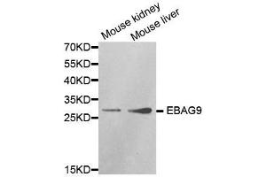Western blot analysis of extracts of various cell lines, using EBAG9 antibody. (RCAS1 antibody  (AA 28-213))