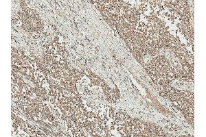 Immunohistochemistry analysis using Rabbit Anti-IGF-1 Polyclonal Antibody (ABIN5066654). (IGF1 antibody  (HRP))