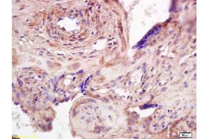 Formalin-fixed and paraffin embedded human placenta labeled with Anti-ADAMTS7 Polyclonal Antibody, Unconjugated (ABIN668586) at 1:200 followed by conjugation to the secondary antibody and DAB staining (ADAMTS7 antibody  (AA 1601-1686))