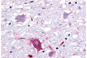 Immunohistochemistry (Formalin/PFA-fixed paraffin-embedded sections) of human brain, neurons and glia with GPR32 polyclonal antibody . (GPR32 antibody  (3rd Extracellular Domain))