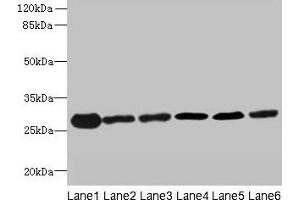 Western blot All lanes: TMED9 antibody at 4. (TMED9 antibody  (AA 40-197))