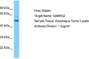 Host: Rabbit Target Name: GABRG2 Sample Type: Esophagus Tumor lysates Antibody Dilution: 1. (GABRG2 antibody  (N-Term))