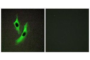 Immunofluorescence (IF) image for anti-STEAP Family Member 4 (STEAP4) (Internal Region) antibody (ABIN1849702) (STEAP4 antibody  (Internal Region))