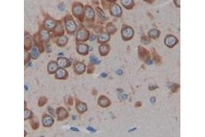 Figure. (HDC antibody  (AA 365-643))