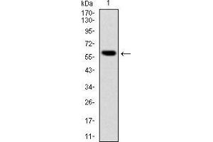 Western blot analysis using BLNK mAb against human BLNK (AA: 34-216) recombinant protein. (B-Cell Linker antibody)
