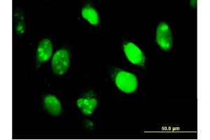 Immunofluorescence of monoclonal antibody to IFI16 on HeLa cell.