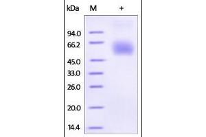 Human Lumican, His Tag on SDS-PAGE under reducing (R) condition. (LUM Protein (AA 19-338) (His tag))